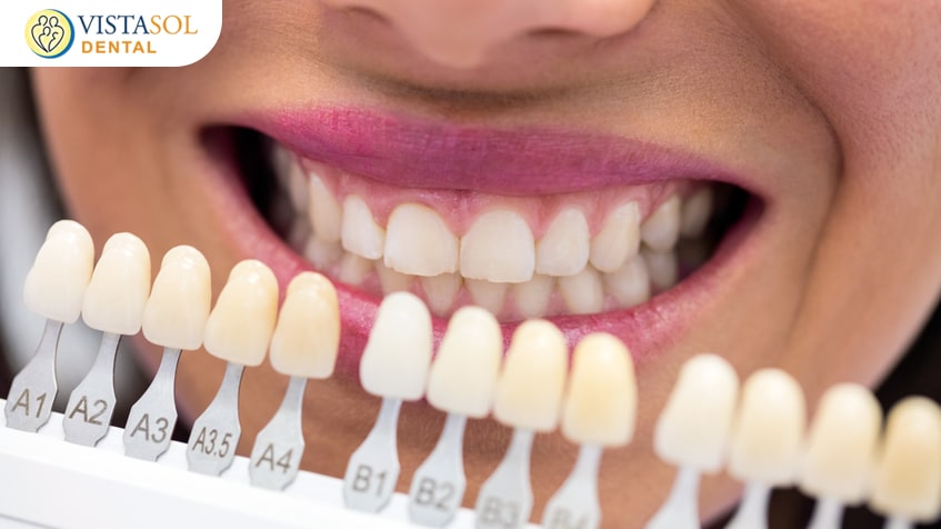 Dental Veneers: Achieving a Flawless Smile By vistasol dental